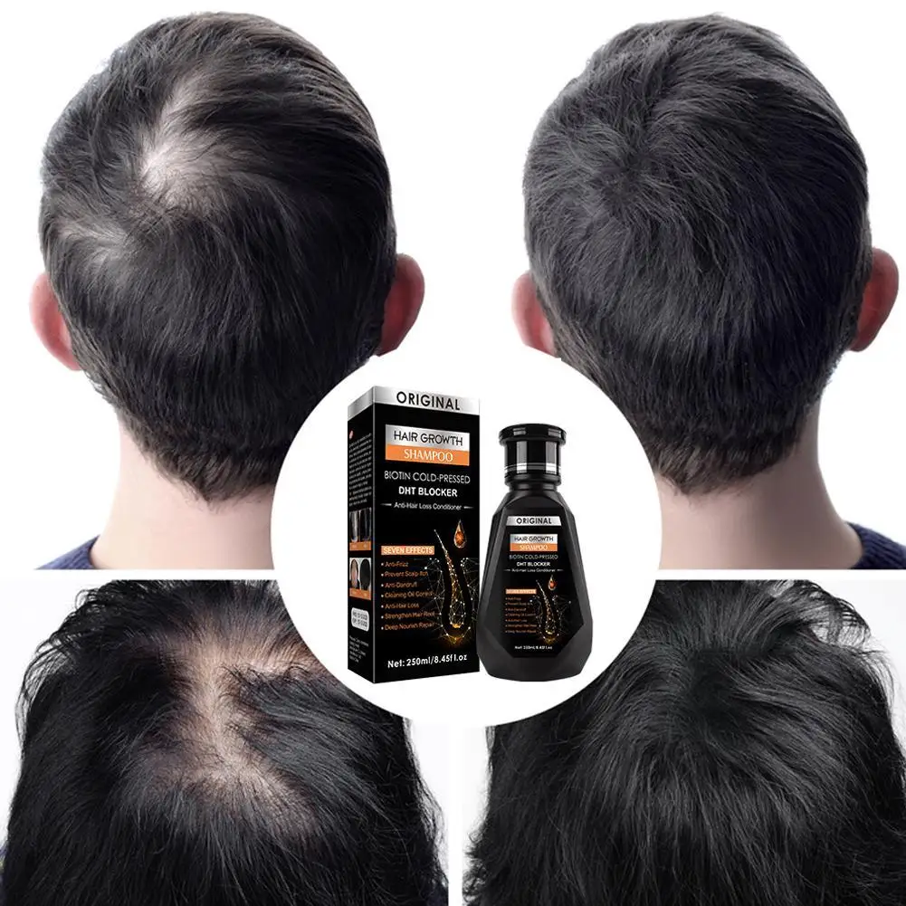 250ML Biotin Shampoo For Hair Growth And Thinning Hair – Ginger Shampoo Thickening Formula For Hair Loss Treatment For Women Men thumbnail 5