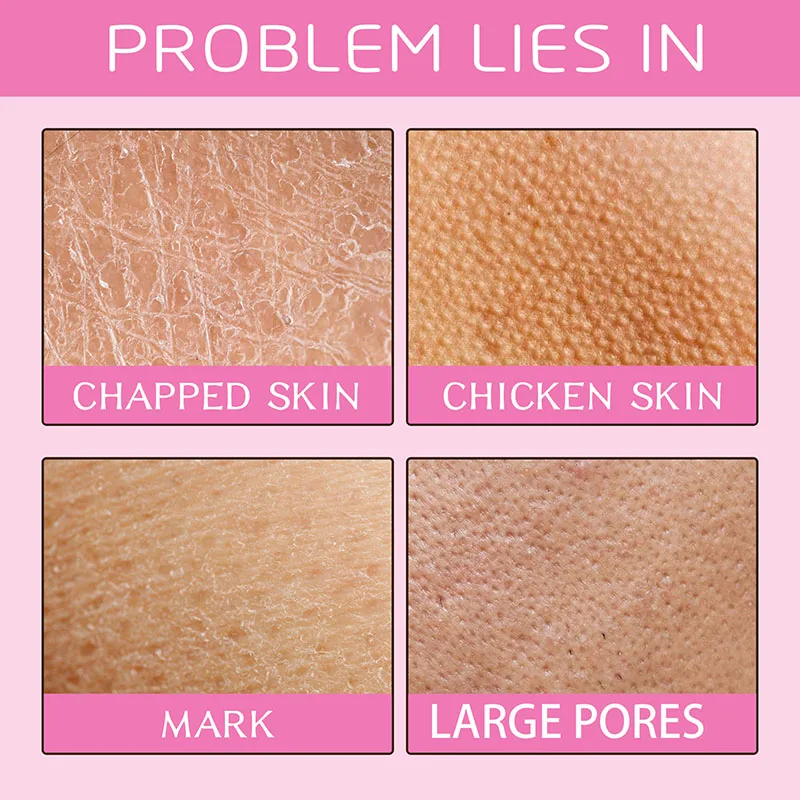60g Body Scrub Cream Exfoliating Bleach Elbow Underarm Knee Melanin Pigmentation Whitening Remove Dead Skin Shower Scrub Care thumbnail 5