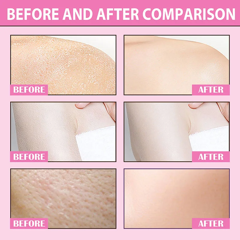 60g Body Scrub Cream Exfoliating Bleach Elbow Underarm Knee Melanin Pigmentation Whitening Remove Dead Skin Shower Scrub Care thumbnail 2