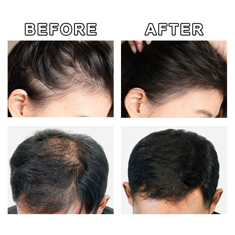 GINZO Hair Concealer for Baldness Dye Hair Corrector Cream for Man Waterproof Fill Up Black Hair Powder Upgraded Home Use 40ml thumbnail 3