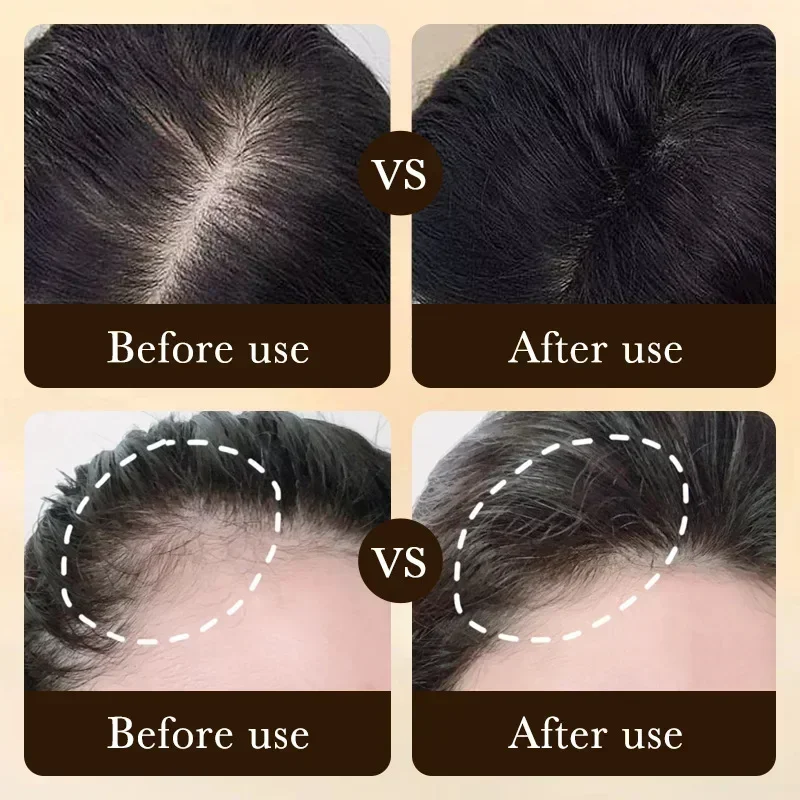 Biotin fast Hair Growth oil Products Care Scalp Massage Treatments Anti Hair Loss Effective Grow Thicker Hair serum for men thumbnail 2