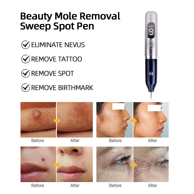 Laser Plasma Pen For Mole Dark Spot Freckle Nevus Wart Skin Tag Pimples Tattoo Removal Skin Face Care Beauty Machine Papilloma thumbnail 5