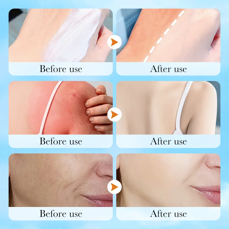 Super 220ml Vitamin E Body And Face Sunscreen Lotion SPF 90 PA++++Whole Body Use Protect + Hydrate Moisturizing thumbnail 6