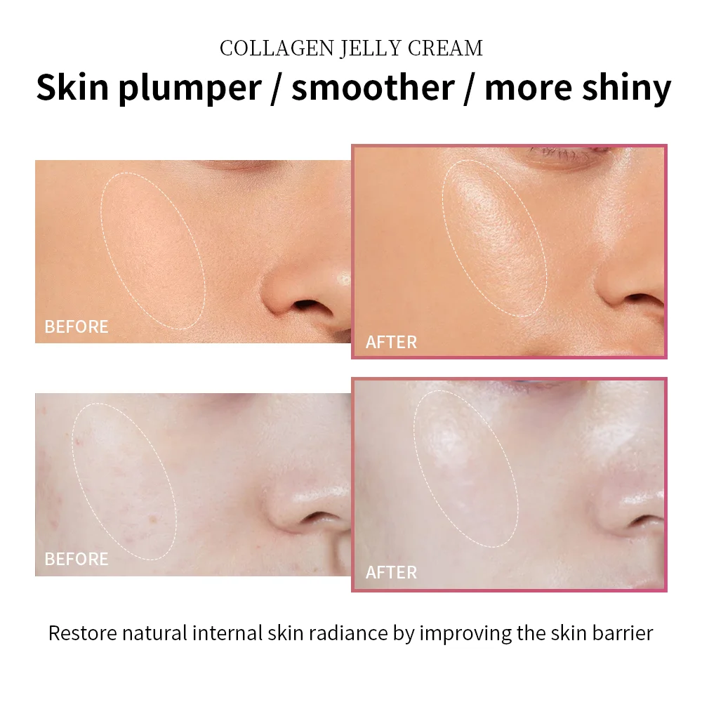Moisturizing Collagen Jelly Cream Niacinamide Hydrolyzed Collagen Tightening Soothing Anti-Aging Firmness Hydration Skincare thumbnail 4