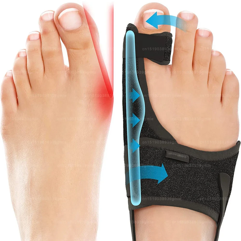 Foot Corrector Bunion Splint Hallux Valgus Correction Big Toe Straightener Orthopedic Corrector Pedicure Bunion Protector Toes