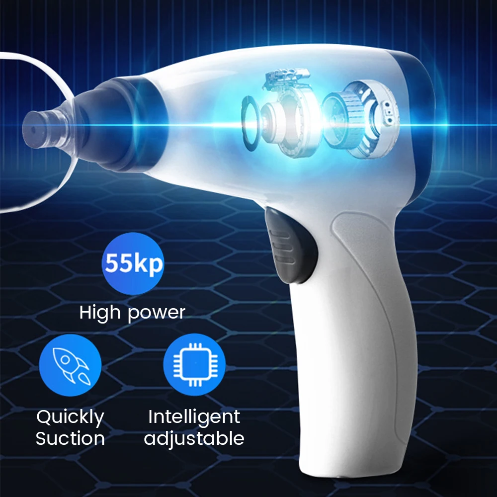 Cupping Therapy Set Electric Vacuum Massage Rechargeable Guasha Massage Scraping Device Beauty Health Physical Fatigue Relieve thumbnail 4