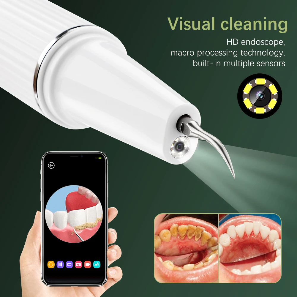 Ultrasonic Dental Scaler Teeth Whitening Tartar Electric Remover Tooth Stain Calculus Oral Care Tool with Camera IPX7 Waterproof thumbnail 3