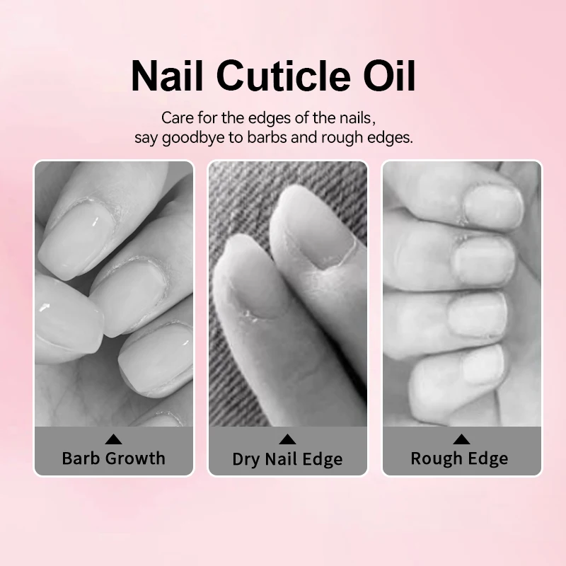 UR SUGAR 15ml Flower Nail Soften Oil Cuticle Remover for Gel Overgrown Cuticles Soften Eliminating Exfoliant for Nails Manicure thumbnail 5