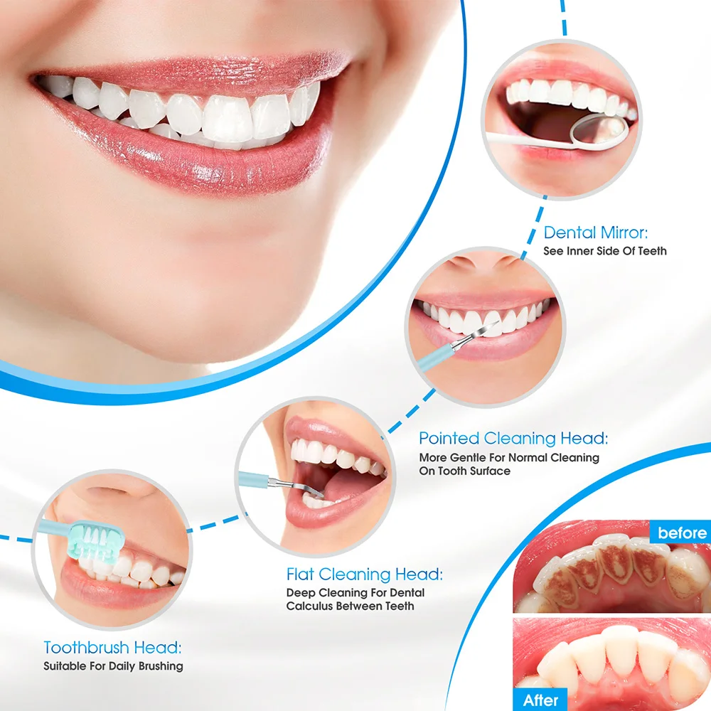 Electric Dental Calculus Remover Dental Cleaning Device Teeth Cleaner Tooth Whitening Irrigator Reduce Tartar Scaler Teeth Care thumbnail 3