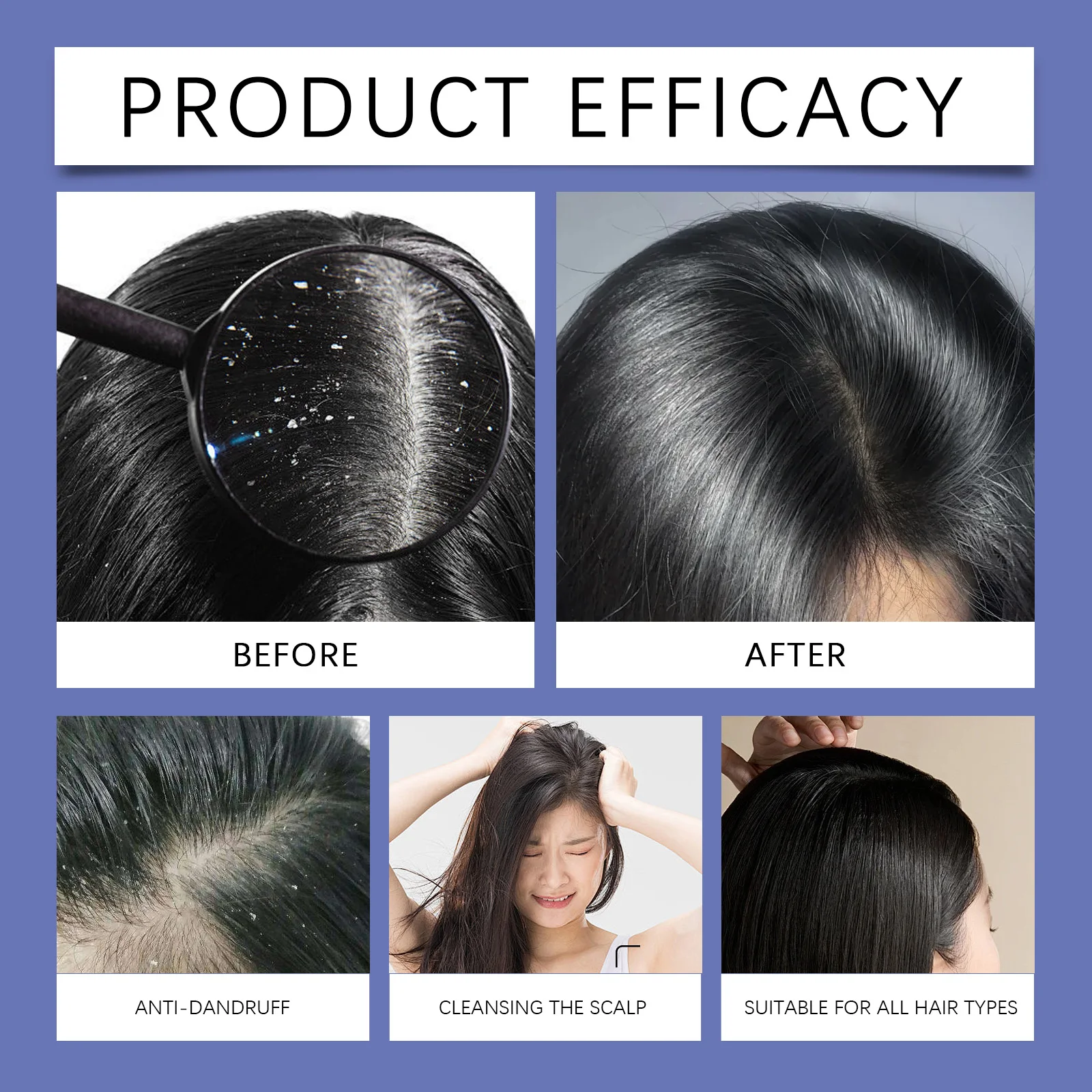 120ml Selenium Sulfide Shampoo Deep Cleansing Remove Dandruff Itchy Balance Oil Nourishing Restoration Hair Color Shampoo thumbnail 5