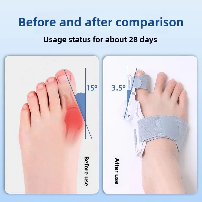 Bunion Corrector Unisex Big Toe Orthopedic Toe Straightener Anti-slip Heel Strap for Left & Right Feet Rotatable Toe Separator thumbnail 2