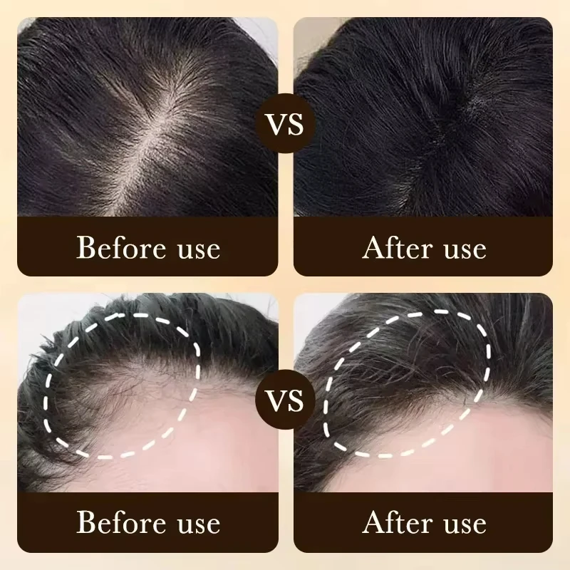 Hair Growth Essential Loss Regrowth Treatment Strengthens Hair Nourishes Scalp Light Weight Non Greasy Improve Scalp Circulation thumbnail 3