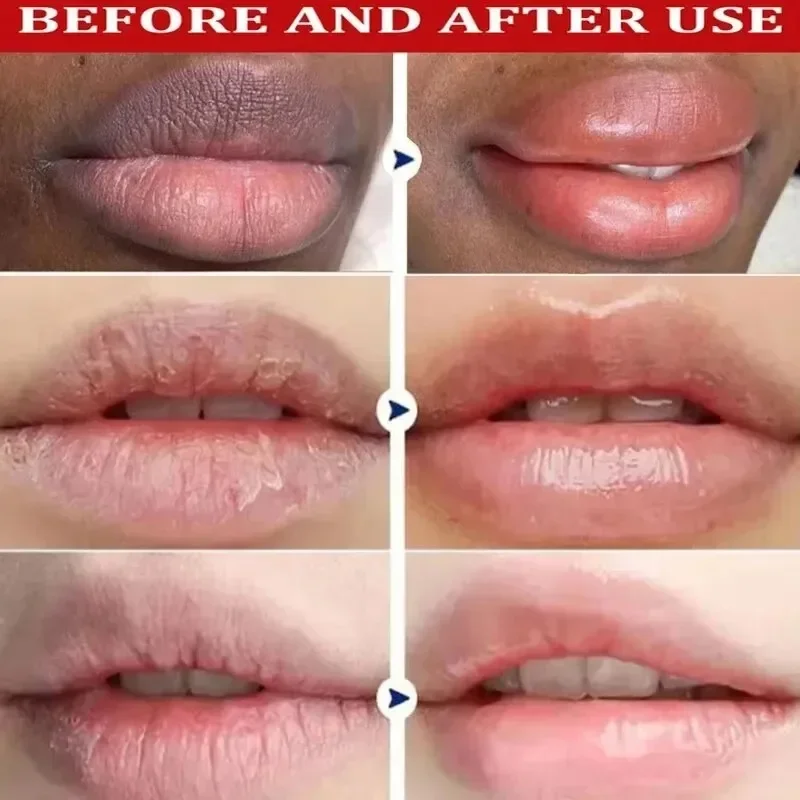 Remove Dark Lip Balm Lightening Melanin Mask Gloss Exfoliating Lip Pink Treatment Reduce Lip Lines Improve Dryness Moisturizing thumbnail 3