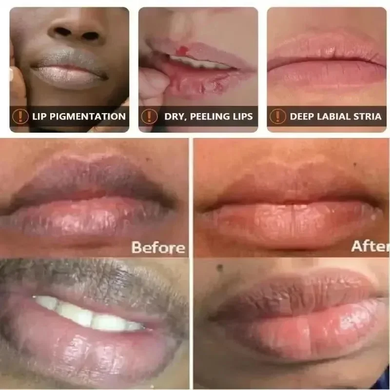 Remove Dark Lip Balm Lightening Melanin Mask Gloss Exfoliating Lip Pink Treatment Reduce Lip Lines Improve Dryness Moisturizing thumbnail 5