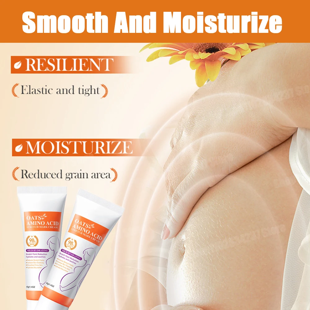 Stretch Marks Removal Cream Light Lines Postpartum Obesity Pregnancy Powerful Fast Absorption thumbnail 4