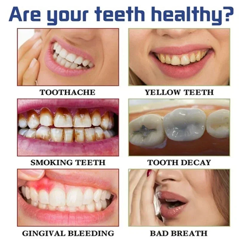 Fast Remove Smoke Stains Toothpaste Remove Plaque Stains Oral Hygiene Cleaning Fresh Breath Teeth Whiten Tools Oral Health Care thumbnail 4