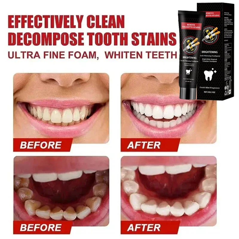Fast Remove Smoke Stains Toothpaste Remove Plaque Stains Oral Hygiene Cleaning Fresh Breath Teeth Whiten Tools Oral Health Care thumbnail 2