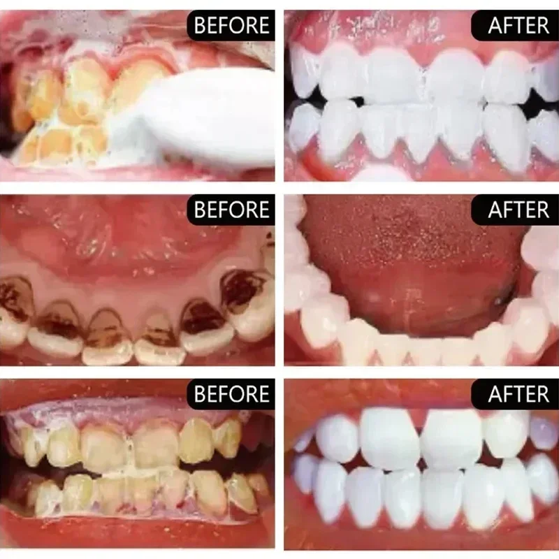 Fast Remove Smoke Stains Toothpaste Remove Plaque Stains Oral Hygiene Cleaning Fresh Breath Teeth Whiten Tools Oral Health Care thumbnail 3