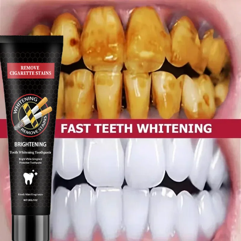 Fast Remove Smoke Stains Toothpaste Remove Plaque Stains Oral Hygiene Cleaning Fresh Breath Teeth Whiten Tools Oral Health Care