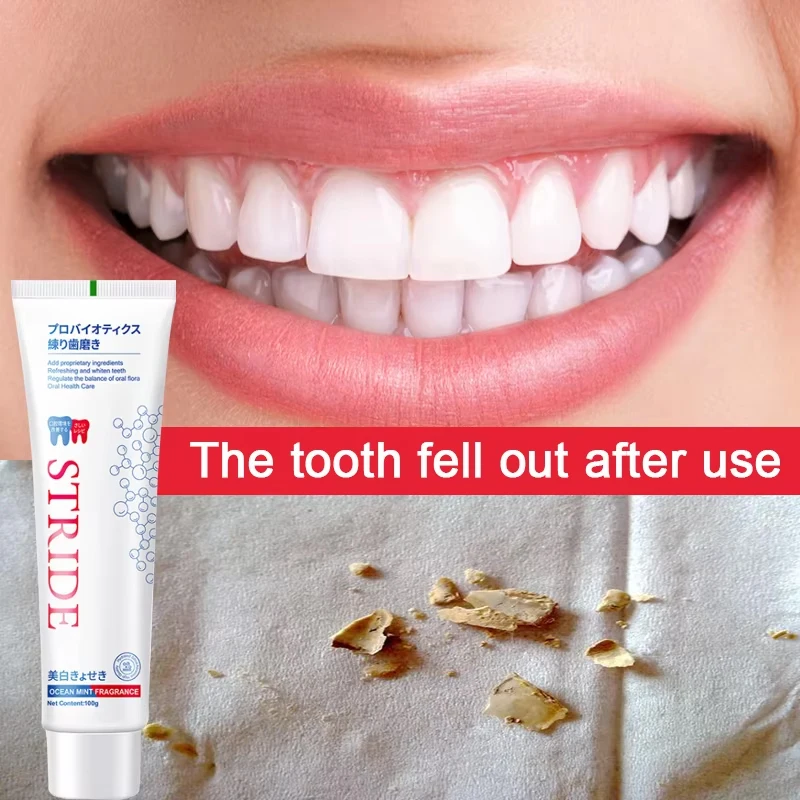 Whitening Toothpaste Fresh Bright Breath Remove Stains Cleaning Teeth Odour Removal Bad Breath Prevent Periodontitis Tooth Care thumbnail 2