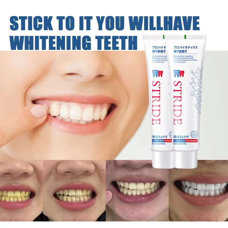 Whitening Toothpaste Fresh Bright Breath Remove Stains Cleaning Teeth Odour Removal Bad Breath Prevent Periodontitis Tooth Care thumbnail 6