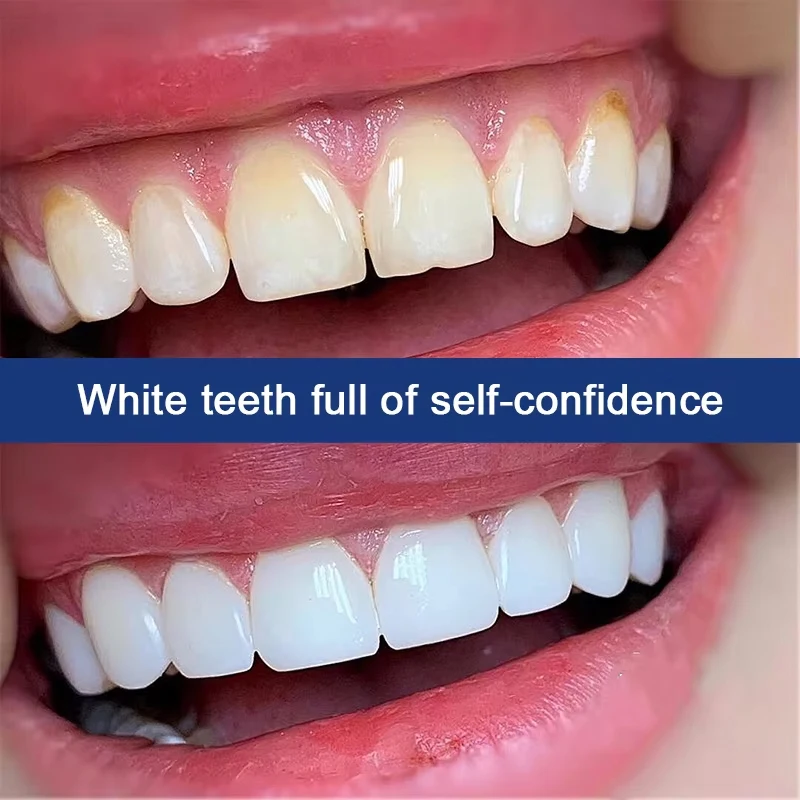 Whitening Toothpaste Fresh Bright Breath Remove Stains Cleaning Teeth Odour Removal Bad Breath Prevent Periodontitis Tooth Care thumbnail 4