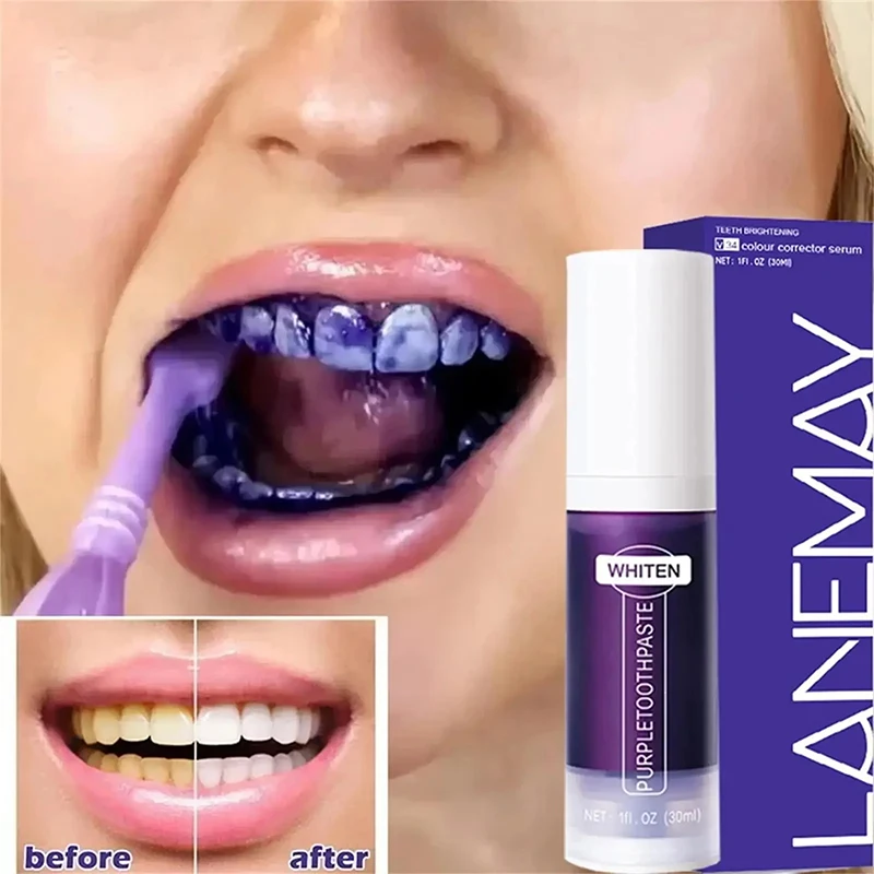 V34 Purple Teeth Whitening Toothpaste Remove Plaque Stains Cleaning Oral Hygiene Dental Bleach Tools Fresh Breath Teeth Care thumbnail 2