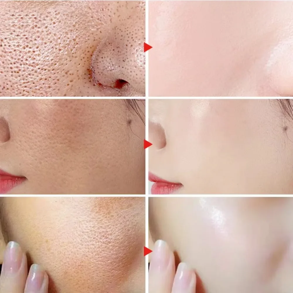 Lactic Acid Large Pores Removal Serum Pore Shrinking Minimizing Essence Moisturizing Firming Smooth Repair Korean Skin Care thumbnail 5