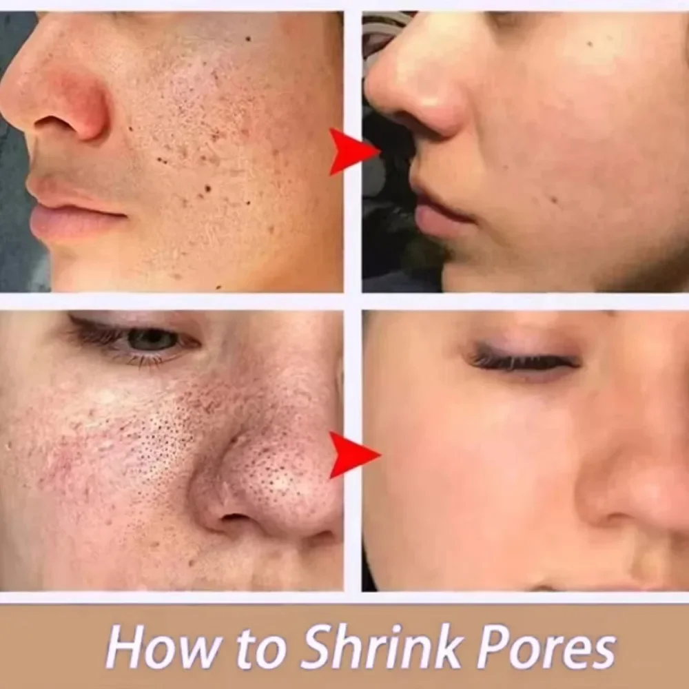 Lactic Acid Large Pores Removal Serum Pore Shrinking Minimizing Essence Moisturizing Firming Smooth Repair Korean Skin Care thumbnail 4