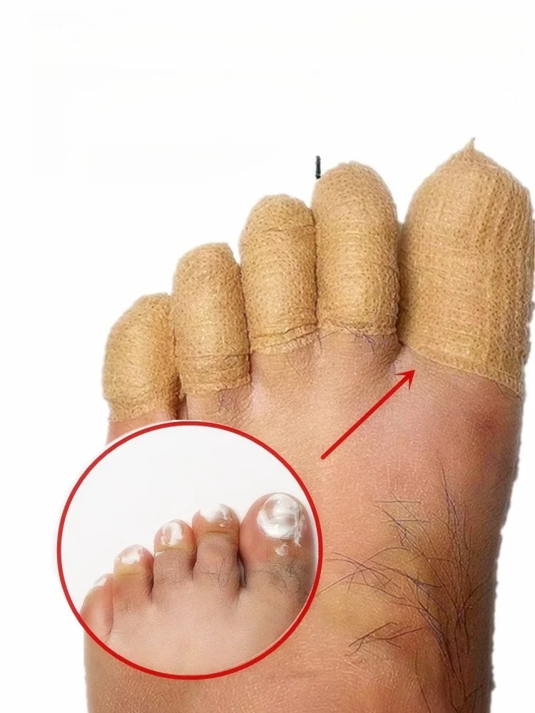 Toe protection, self-adhesive bandage, fungal nail polish, foot and finger protection, nail coating, toe and finger protection thumbnail 5