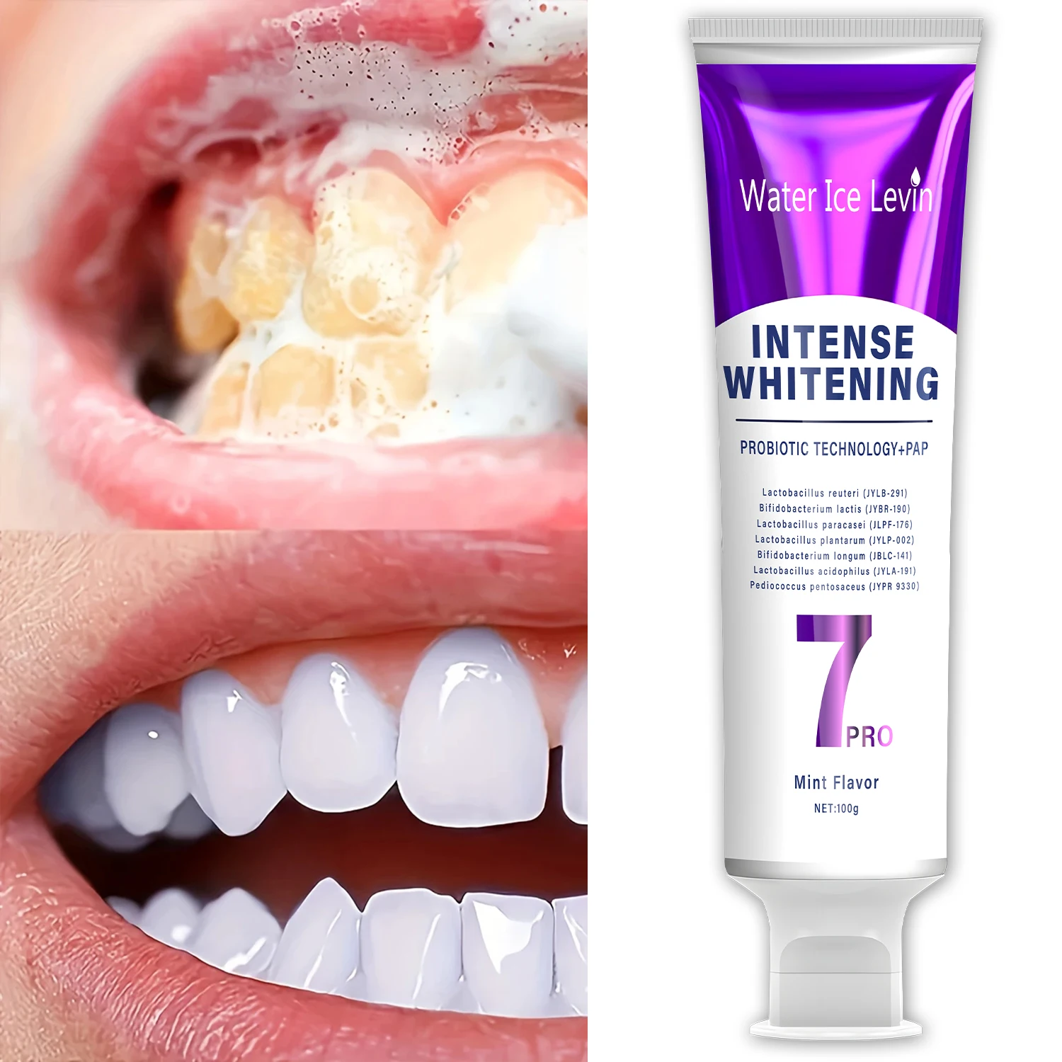 Probiotic Whitening Toothpaste - Helps Maintain Healthy Gums, Keeps Breath Fresh, Oral Care Set - Suitable for the Whole Family thumbnail 5