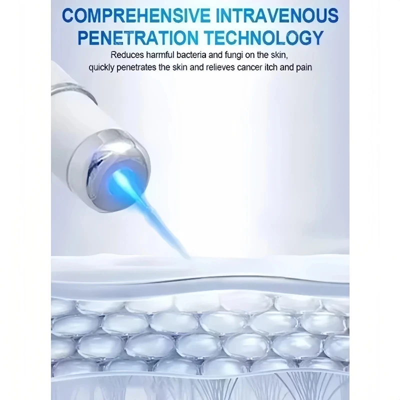 Blue Light Laser Vein Therapy | At-Home Treatment for Spider Veins & Swelling | Safe for Couperose Skin thumbnail 5
