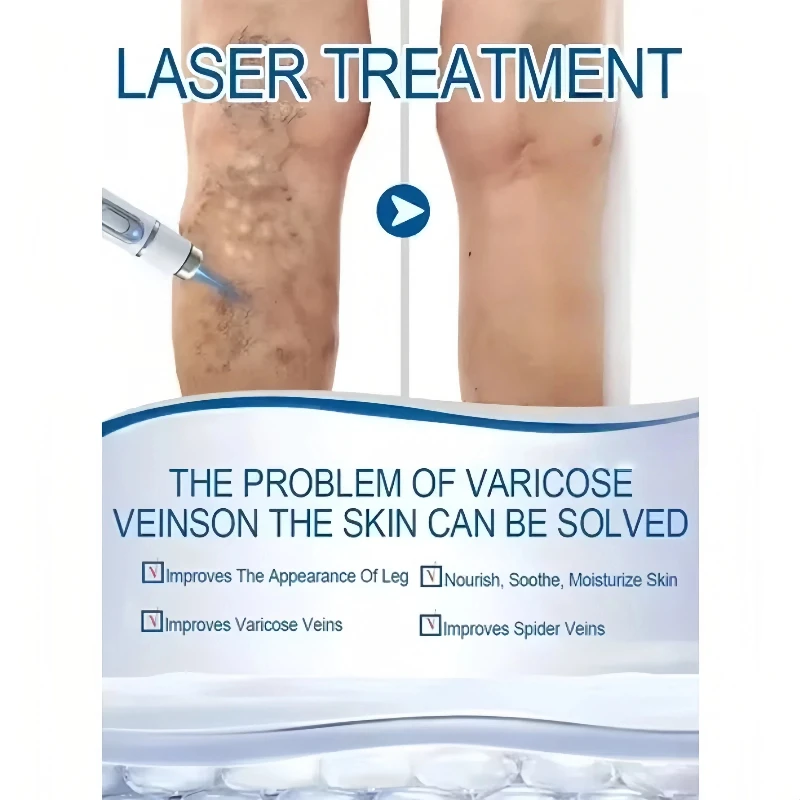 Blue Light Laser Vein Therapy | At-Home Treatment for Spider Veins & Swelling | Safe for Couperose Skin thumbnail 4