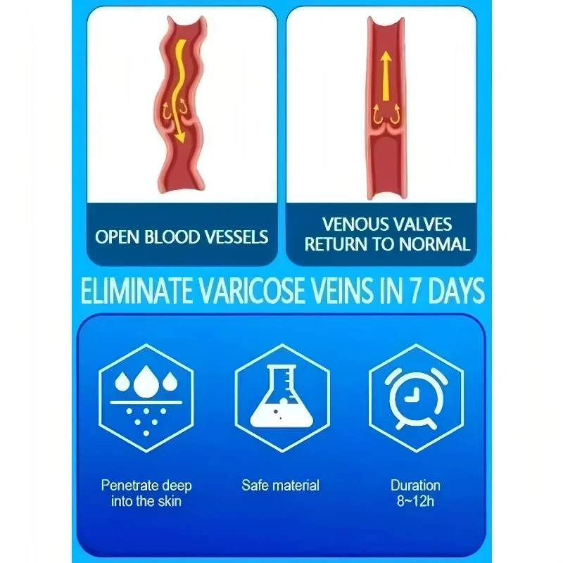 Blue Light Laser Vein Therapy | At-Home Treatment for Spider Veins & Swelling | Safe for Couperose Skin thumbnail 6