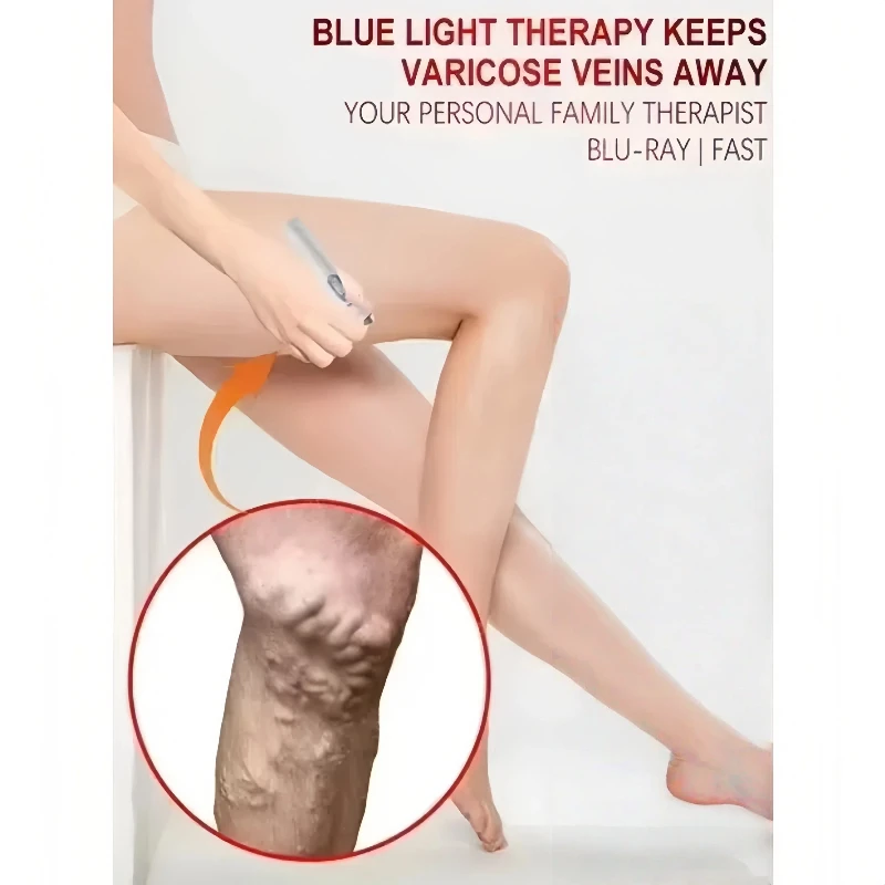 Blue Light Laser Vein Therapy | At-Home Treatment for Spider Veins & Swelling | Safe for Couperose Skin thumbnail 3