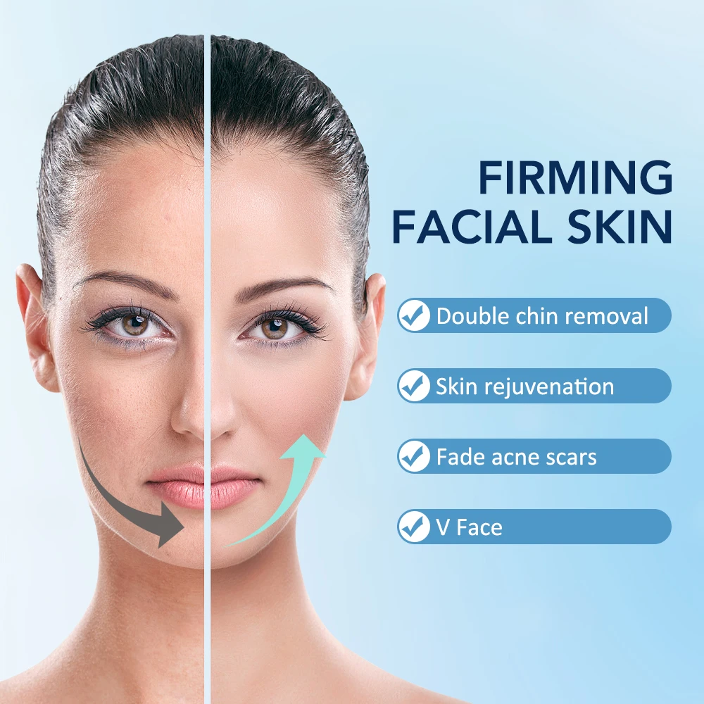 Electric Face Lifting Device Micro-Current V-Face Double Chin Remover Smart Facial Massager Beauty Skin Care Chin Lift Up Belt thumbnail 5