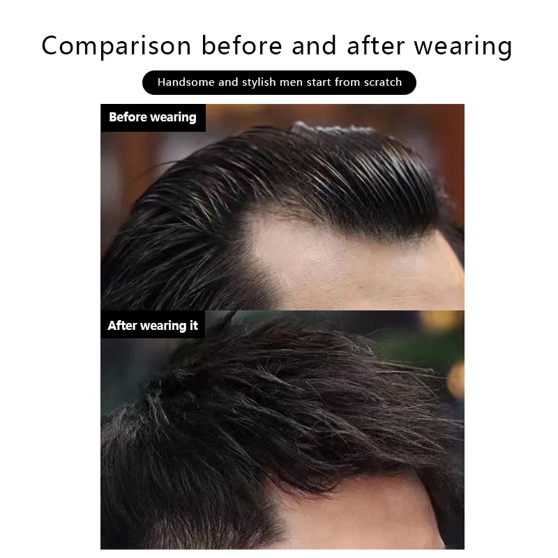 Men's Forehead Patch Hairpiece Sideburns Toupee 100% Human Hair  Invisible Seamless Ultra Thin Skin PU Hairline Sideburn Patch thumbnail 4