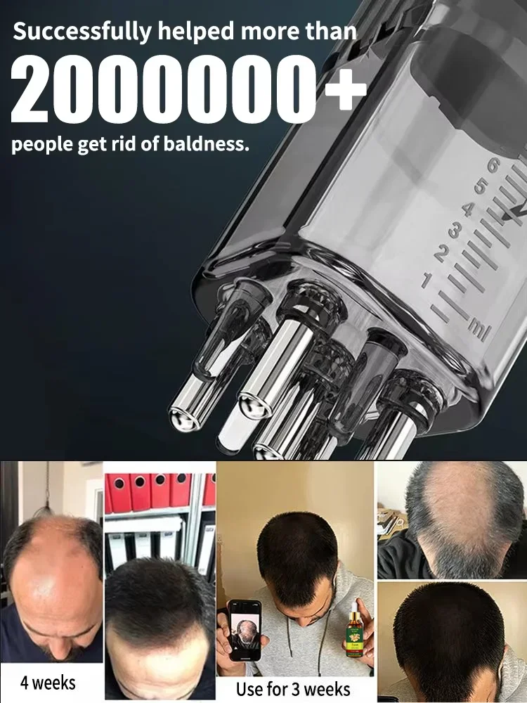 98% of buyers buy again, have more and more hair, say goodbye to baldness, thick hair,Hot selling product thumbnail 2