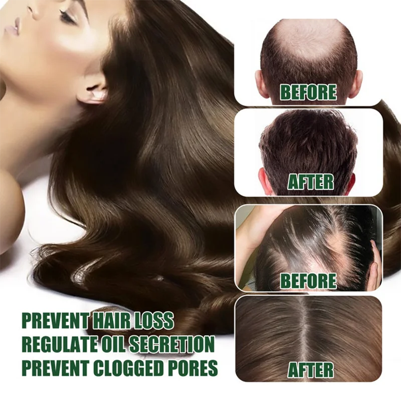 98% of buyers buy again, have more and more hair, say goodbye to baldness, thick hair,Hot selling product thumbnail 4