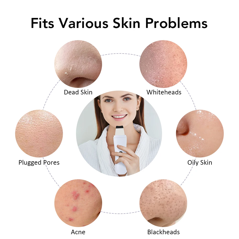 Ultrasonic Skin Scrubber Face Pore Cleaner Deep Cleansing Tool with 4 Modes Peeling Blackhead Remover for Facial Skincare thumbnail 4