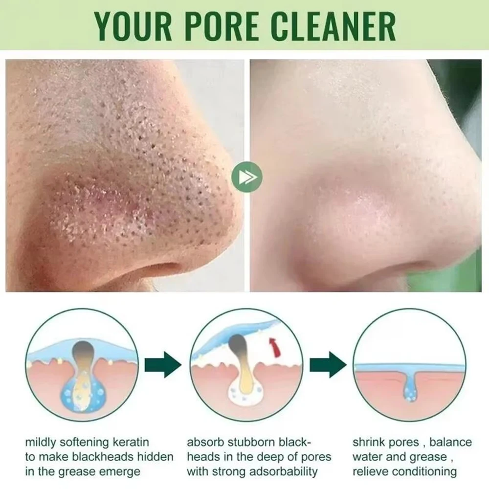Original Facial Remove Blackhead Green Tea Solid Mask Treat Acne Blemish Black Dots Clean Stick Cream Shrink Pores Skin Care thumbnail 4