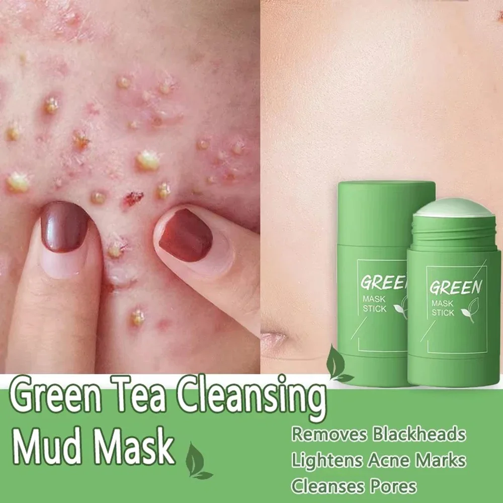 Original Facial Remove Blackhead Green Tea Solid Mask Treat Acne Blemish Black Dots Clean Stick Cream Shrink Pores Skin Care thumbnail 3