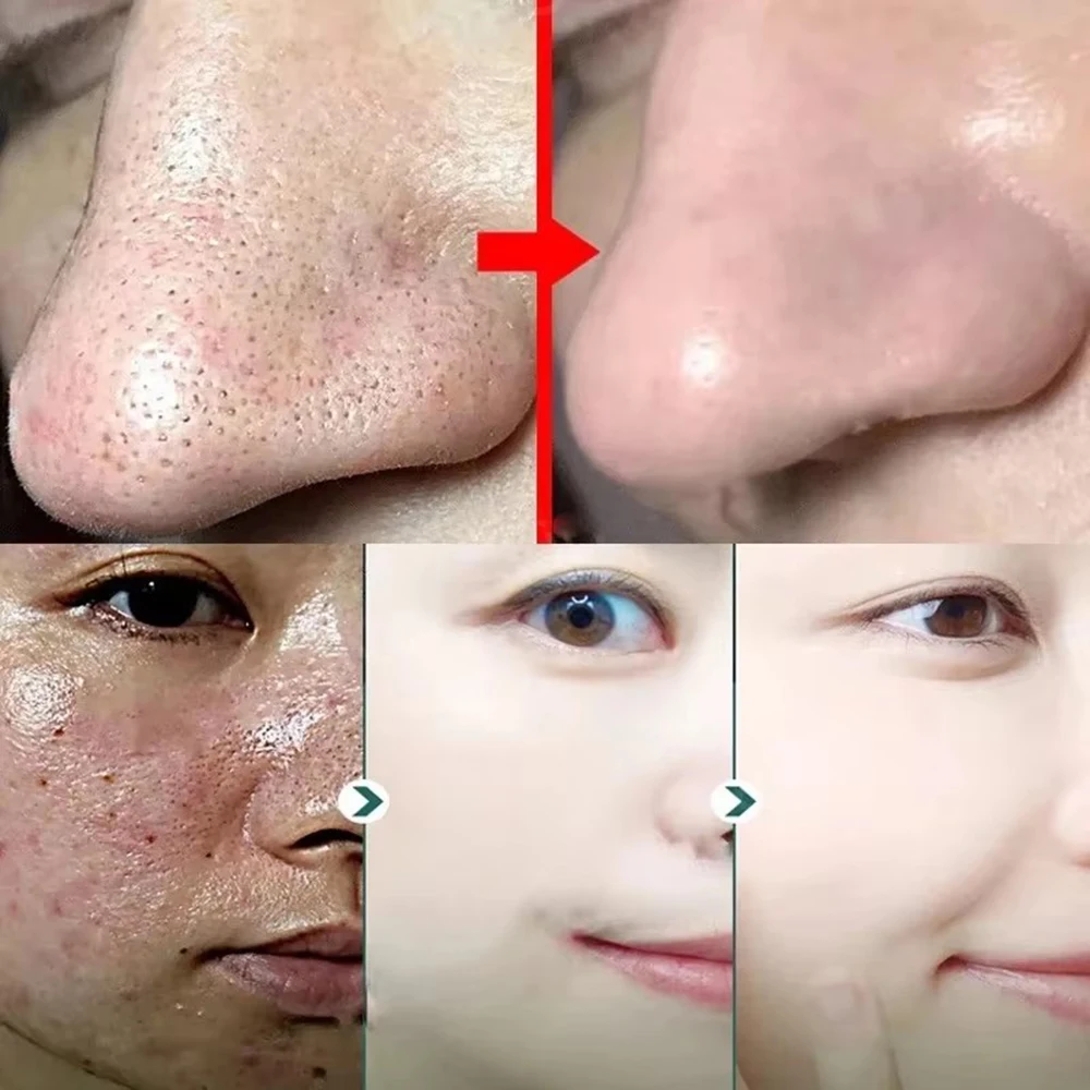Original Facial Remove Blackhead Green Tea Solid Mask Treat Acne Blemish Black Dots Clean Stick Cream Shrink Pores Skin Care thumbnail 2