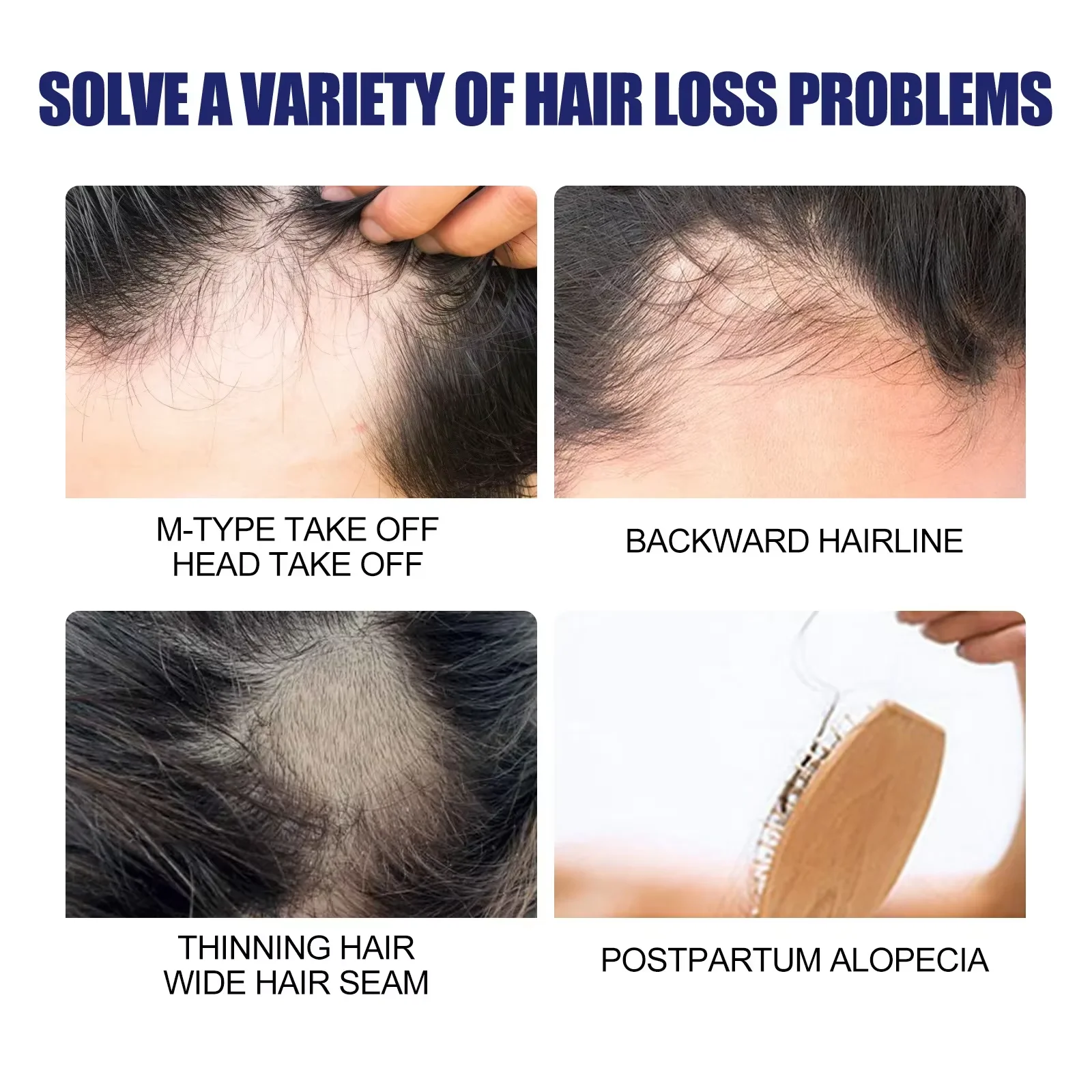 Powerful Hair Growth Foam Anti Loss Fast Growing Scalp Damaged Hair Repair Strengthen Thicker Nourish Regrowth Hair Foam for Men thumbnail 3