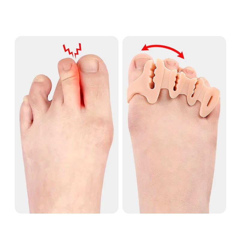 Forefoot Pad Four-hole Flip-flops Toe Splitter Slippers And Sandals Toe Splitter Thumb Eversion And Toe Overlap Separator thumbnail 5