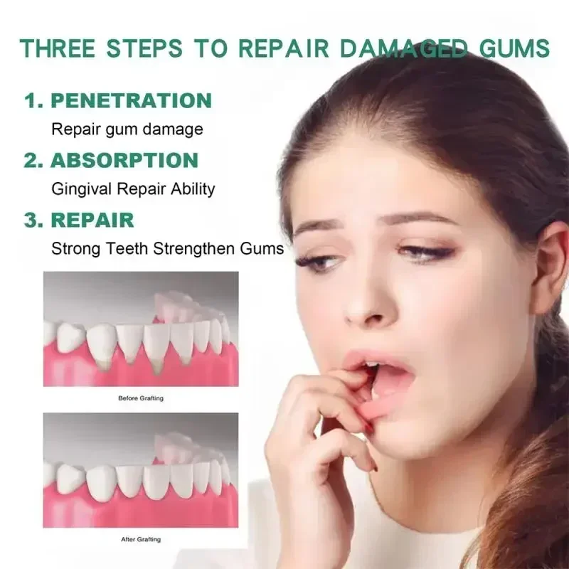 Brighten Your Smile: Top Teeth Whitening Solutions for a Dazzling Look thumbnail 4