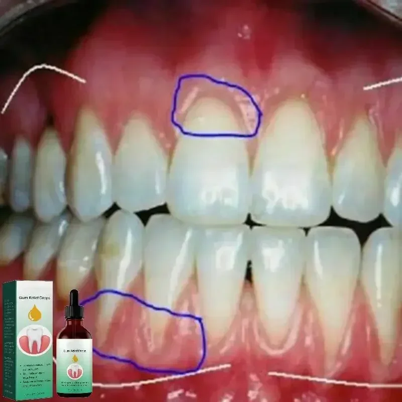 Brighten Your Smile: Top Teeth Whitening Solutions for a Dazzling Look thumbnail 3
