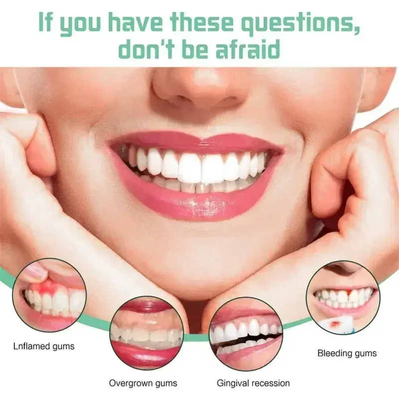 Brighten Your Smile: Top Teeth Whitening Solutions for a Dazzling Look thumbnail 5