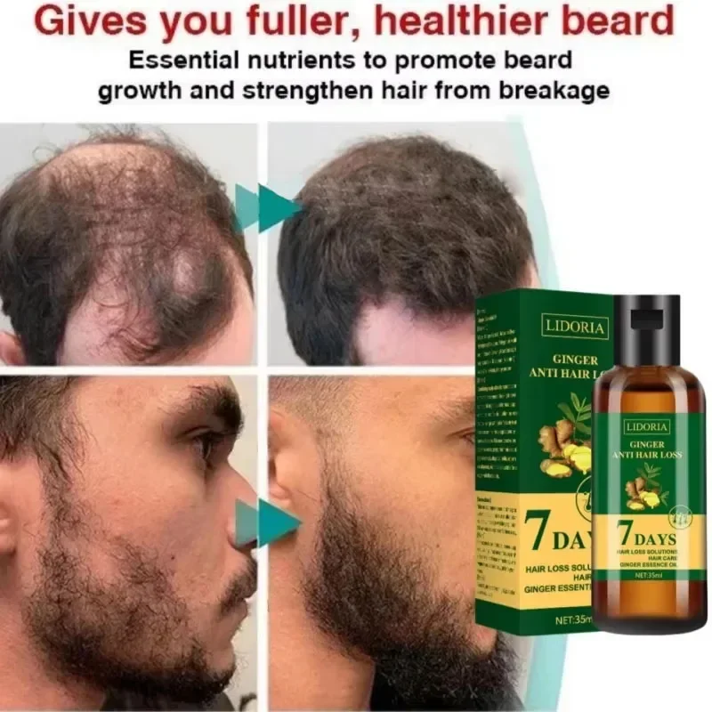 Hair Growth Serum 7 Days Fast Regrowth Essential Capsule Anti Hair loss Baldness Repair Damaged Scalp Treatment For Women Men thumbnail 3