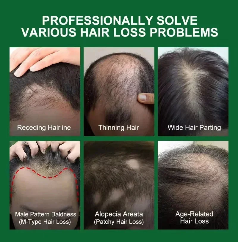 Hair Growth Serum 7 Days Fast Regrowth Essential Capsule Anti Hair loss Baldness Repair Damaged Scalp Treatment For Women Men thumbnail 2